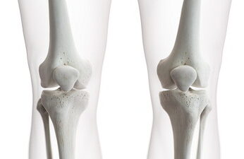 膝の骨の構造
